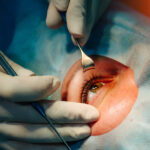 How to Choose a LASIK Surgeon in Portland, Maine